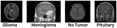 Enhancing brain tumor classification in MRI scans with a multi-layer customized convolutional neural network approach